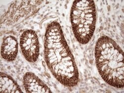 LIMA1 Mouse anti-Human, Clone: OTI1A3, TrueMAB , Origene 30 &mu;L; Unconjugated:Antibodies,