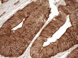 LIMA1 Mouse anti-Human, Clone: OTI1A3, TrueMAB , Origene 30 &mu;L; Unconjugated:Antibodies,