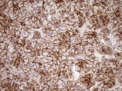 LIMA1 Monoclonal Antibody (OTI7H8), TrueMAB , OriGene 100 &mu;L; Unconjugated:Antibodies,