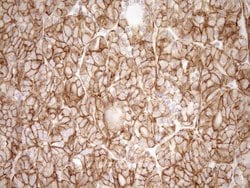 LIMA1 Monoclonal Antibody (OTI7H8), TrueMAB , OriGene 100 &mu;L; Unconjugated:Antibodies,