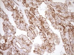 LIMA1 Monoclonal Antibody (OTI7H8), TrueMAB , OriGene 100 &mu;L; Unconjugated:Antibodies,