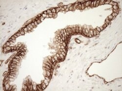 LIMA1 Monoclonal Antibody (OTI7H8), TrueMAB , OriGene 100 &mu;L; Unconjugated:Antibodies,