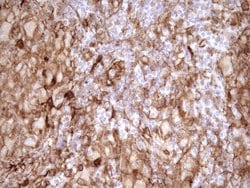 LIMA1 Monoclonal Antibody (OTI7H8), TrueMAB , OriGene 100 &mu;L; Unconjugated:Antibodies,