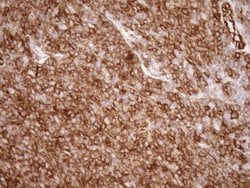 LIMA1 Monoclonal Antibody (OTI7H8), TrueMAB , OriGene 100 &mu;L; Unconjugated:Antibodies,