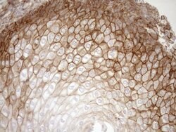 LIMA1 Monoclonal Antibody (OTI7H8), TrueMAB , OriGene:Antibodies:Primary