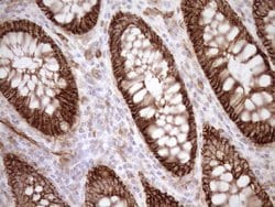 LIMA1 Monoclonal Antibody (OTI7H8), TrueMAB , OriGene 100 &mu;L; Unconjugated:Antibodies,
