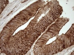 LIMA1 Monoclonal Antibody (OTI7H8), TrueMAB , OriGene 100 &mu;L; Unconjugated:Antibodies,