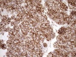 LIMA1 Monoclonal Antibody (OTI7H5), TrueMAB , OriGene 100 &mu;L; Unconjugated:Antibodies,