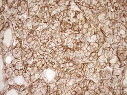 LIMA1 Monoclonal Antibody (OTI7H5), TrueMAB , OriGene 100 &mu;L; Unconjugated:Antibodies,