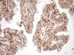 LIMA1 Monoclonal Antibody (OTI7H5), TrueMAB , OriGene 100 &mu;L; Unconjugated:Antibodies,