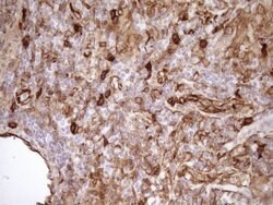 LIMA1 Monoclonal Antibody (OTI7H5), TrueMAB , OriGene 100 &mu;L; Unconjugated:Antibodies,