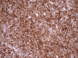 LIMA1 Monoclonal Antibody (OTI7H5), TrueMAB , OriGene 100 &mu;L; Unconjugated:Antibodies,