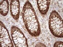 LIMA1 Monoclonal Antibody (OTI7H5), TrueMAB , OriGene 100 &mu;L; Unconjugated:Antibodies,
