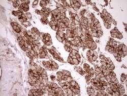 LIMA1 Monoclonal Antibody (OTI8F7), TrueMAB , OriGene 30 &mu;L | Buy Online | Origene Technologies | Fisher Scientific