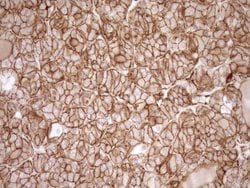 LIMA1 Monoclonal Antibody (OTI8F7), TrueMAB , OriGene 30 &mu;L | Buy Online | Origene Technologies | Fisher Scientific