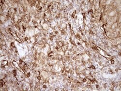 LIMA1 Monoclonal Antibody (OTI8F7), TrueMAB , OriGene 30 &mu;L | Buy Online | Origene Technologies | Fisher Scientific