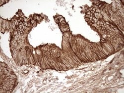 LIMA1 Monoclonal Antibody (OTI8F7), TrueMAB , OriGene 30 &mu;L | Buy Online | Origene Technologies | Fisher Scientific