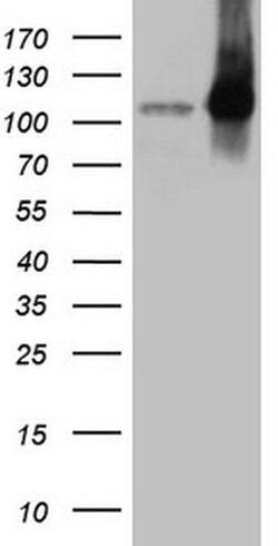 LIMA1 Monoclonal Antibody (OTI7H8), TrueMAB , OriGene 100 &mu;L; Unconjugated:Antibodies,
