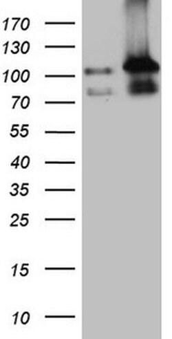 LIMA1 Monoclonal Antibody (OTI7H5), TrueMAB , OriGene 100 &mu;L; Unconjugated:Antibodies,