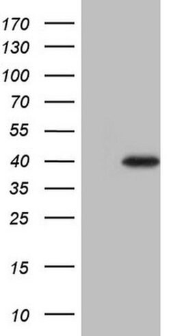 LIME1 Monoclonal Antibody (OTI7A9), TrueMAB , OriGene 100 &mu;L | Buy Online | Origene Technologies | Fisher Scientific