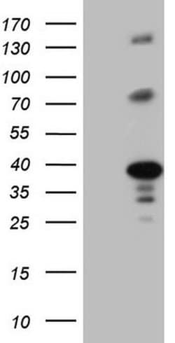 LIME1 Monoclonal Antibody (OTI9E9), TrueMAB , OriGene:Antibodies:Primary