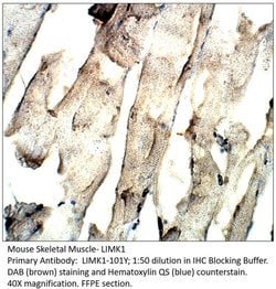 LIMK1 Chicken anti-Human, Mouse, Rat, Polyclonal, FabGennix 200 &mu;L;