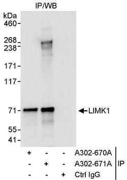 LIMK1 Rabbit anti-Human, Polyclonal, Bethyl Laboratories 100 &mu;L; Unconjugated:Antibodies,