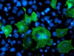 LIMK1 Monoclonal Antibody (OTI3G3), TrueMAB , OriGene 30 &mu;L; Unconjugated:Antibodies,