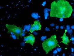 LIMK1 Monoclonal Antibody (OTI8B2), TrueMAB , OriGene:Antibodies:Primary