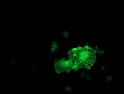 LIMK1 Monoclonal Antibody (OTI8C8), TrueMAB , OriGene 100 &mu;L; Unconjugated:Antibodies,