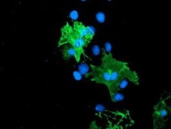 LIMK1 Mouse anti-Human, Clone: OTI 7C3, lyophilized, TrueMAB 100 &mu;g;