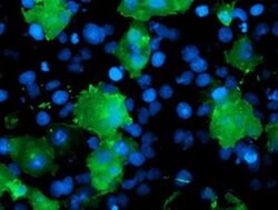 LIMK1 Monoclonal Antibody (OTI2A11), TrueMAB , OriGene 100 &mu;L; Unconjugated:Antibodies,
