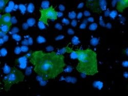 LIMK1 Monoclonal Antibody (OTI1F1), TrueMAB , OriGene 100 &mu;L; Unconjugated:Antibodies,