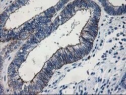 LIMK1 Monoclonal Antibody (OTI3G3), TrueMAB , OriGene 30 &mu;L; Unconjugated:Antibodies,