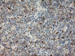 LIMK1 Monoclonal Antibody (OTI3G3), TrueMAB , OriGene 30 &mu;L; Unconjugated:Antibodies,