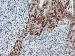 LIMK1 Monoclonal Antibody (OTI8C8), TrueMAB , OriGene 100 &mu;L; Unconjugated:Antibodies,