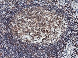 LIMK1 Monoclonal Antibody (OTI8C8), TrueMAB , OriGene 100 &mu;L; Unconjugated:Antibodies,