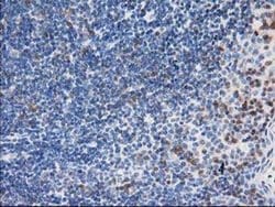 LIMK1 Monoclonal Antibody (OTI2A11), TrueMAB , OriGene:Antibodies:Primary