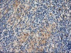 LIMK1 Monoclonal Antibody (OTI2A11), TrueMAB , OriGene 100 &mu;L; Unconjugated:Antibodies,