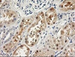 LIMK1 Monoclonal Antibody (OTI2A11), TrueMAB , OriGene 100 &mu;L; Unconjugated:Antibodies,
