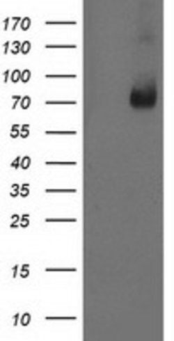 LIMK1 Monoclonal Antibody (OTI8B2), TrueMAB , OriGene 30 &mu;L; Unconjugated:Antibodies,