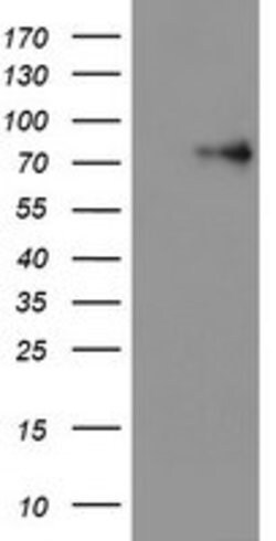 LIMK1 Monoclonal Antibody (OTI8C8), TrueMAB , OriGene 100 &mu;L; Unconjugated:Antibodies,