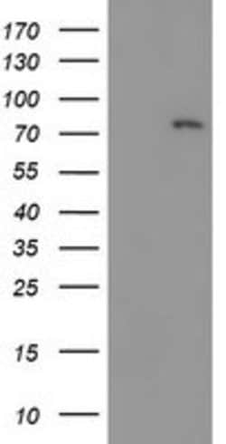 LIMK1 Mouse anti-Canine, Human, Mouse, Rat, Clone: OTI6B4, liquid, TrueMAB