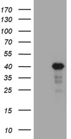 LIMS2 Monoclonal Antibody (OTI5H8), TrueMAB , OriGene:Antibodies:Primary