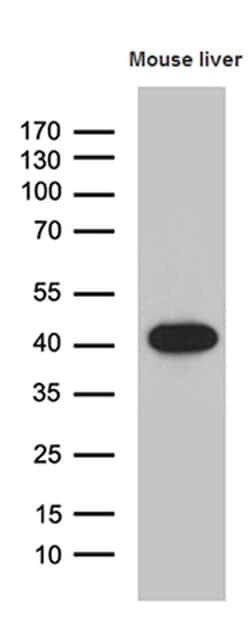 LIMS2 Monoclonal Antibody (OTI5H8), TrueMAB , OriGene:Antibodies:Primary