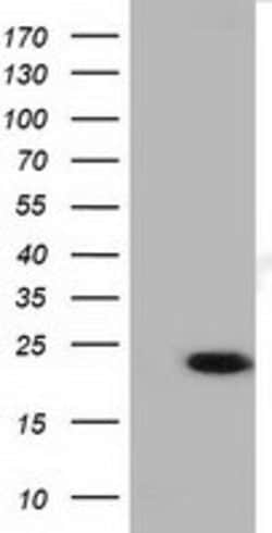 LIN7B Monoclonal Antibody (OTI1G1), TrueMAB , OriGene 100 &mu;L; Unconjugated:Antibodies,