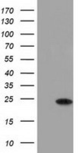 LIN7B Monoclonal Antibody (OTI1C1), TrueMAB , OriGene 100 &mu;L | Buy Online | Origene Technologies | Fisher Scientific