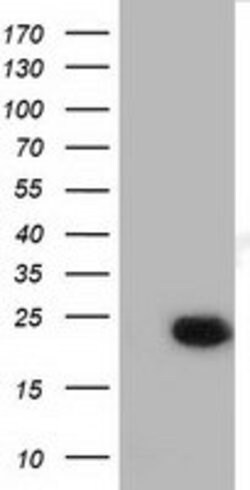 LIN7B Mouse anti-Human, Clone: OTI1G2, lyophilized, TrueMAB 100 &mu;g;
