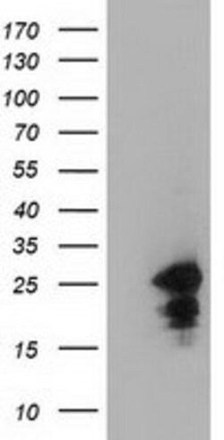 LIN7B Monoclonal Antibody (OTI1E3), TrueMAB , OriGene 100 &mu;L; Unconjugated:Antibodies,