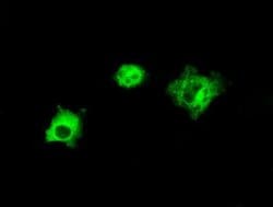 LIPG Monoclonal Antibody (OTI9C5), TrueMAB , OriGene 100 &mu;L; Unconjugated:Antibodies,